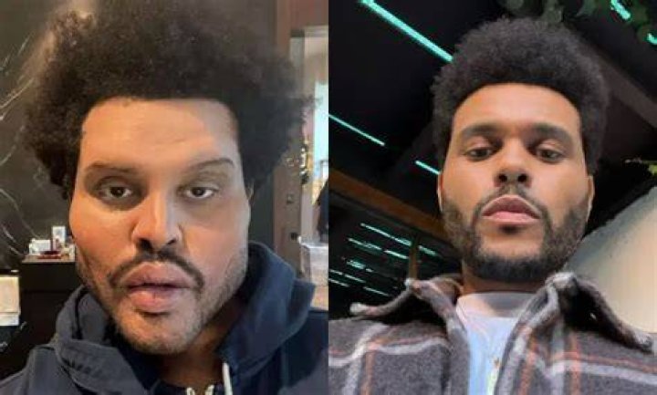A New Face The Weeknd Shows Off Latest Transformation Ahead of Album Release