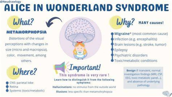 Alice in Wonderland Syndrome