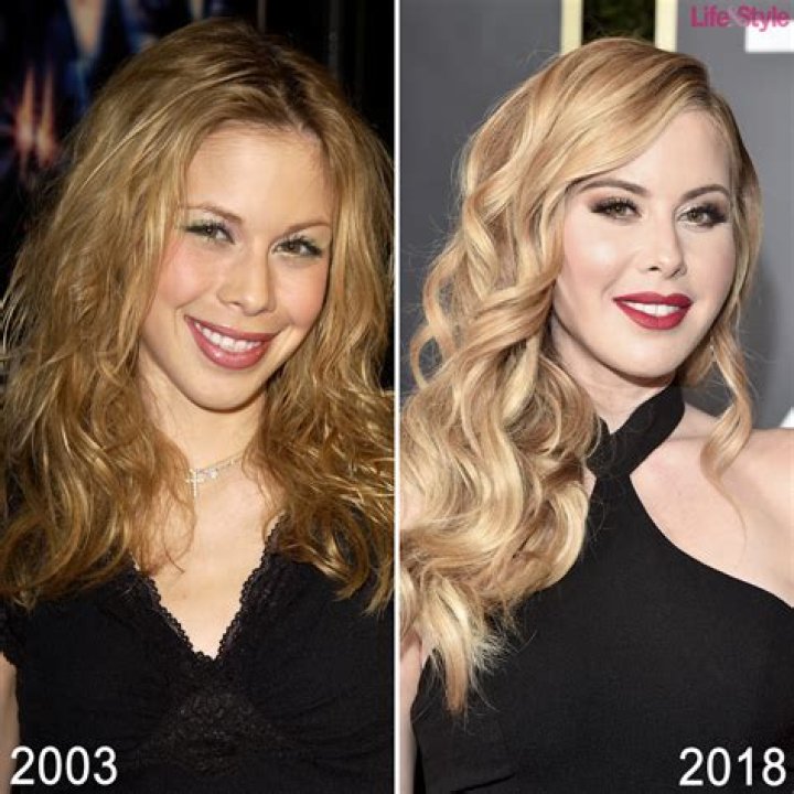 Tara lipinski plastic surgery olympics