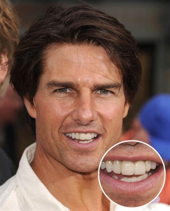 tom cruise middle tooth tom cruise middle tooth